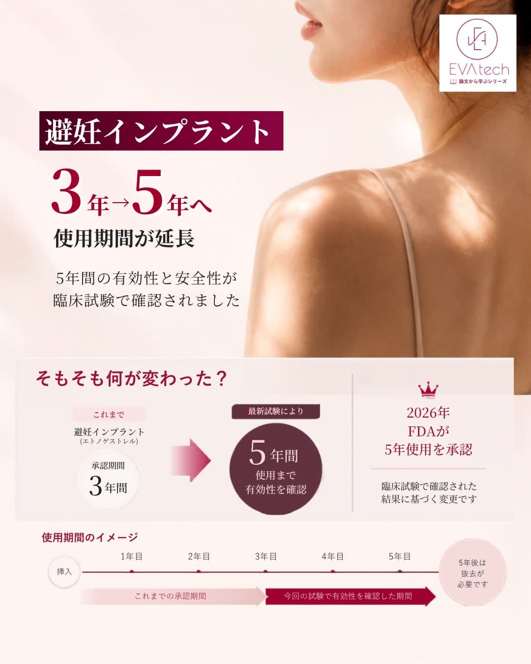 避妊インプラントの承認期間が3年から5年へ延長された根拠を紹介するビジュアル