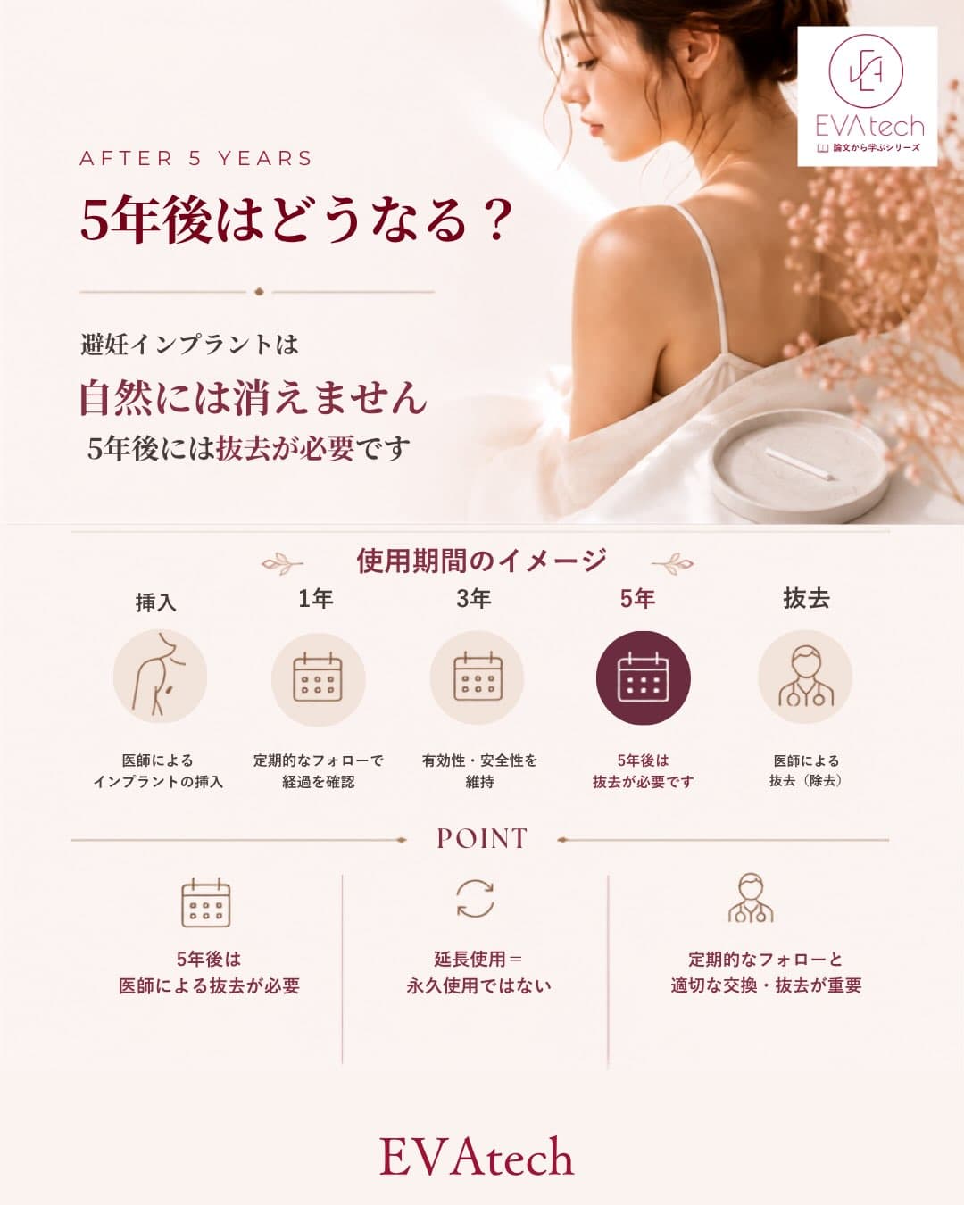 避妊インプラント挿入から1年・3年・5年の経過と、5年後に医師による抜去が必要になるまでの流れを示したタイムライン図